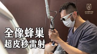 【超皮秒雷射】#全像聚焦模式｜金貞醫學美容｜Dr.Keegan #顏義標醫師