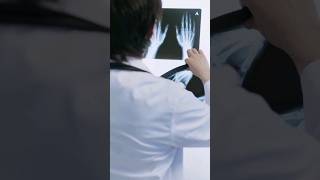 X-RAY EXAMINATION || DR. ORTHO || FRACTURE || BONE || SHORT || RADIOLOGY