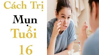 Seri Nặn Mụn-Part 32 Mụn tuổi 16