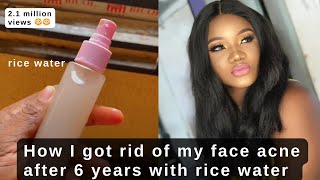 I used rice water for 3 days on my face 😱😱 #ricewaterforface #skincare #shorts #fyp #trending