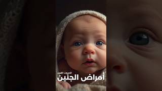 أمراض الجنين فترة الحمل * سامر يونس #shorts #الحمل #الجنين #embryo