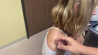 Shoulder taping A/C joint and Glenohumeral Joint