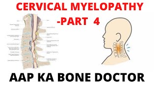 CERVICAL MYELOPATHY - PART 4 - EPISODE 11