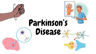 Parkinson's Disease