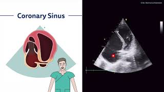 〖Echocardiography〗 Apical views - coronary sinus, CW & PW AV, atypical lateral view 💖