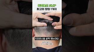 두피문신 SMP의 최대 장점