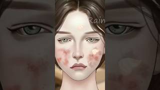 ASMR Big Acne & Maggot Infested Face Removal Animation #shorts #ytshort #youtubeshorts