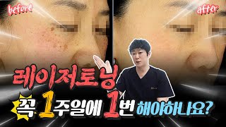 레이저토닝. 1주일에 1번씩 해야 효과가 있을까??