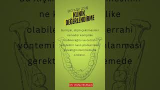 Çene kemiğindeki yer durumu cerrahi zorluğu belirler. 🦷✨#20likDiş #AğızSağlığı #ÇeneCerrahisi