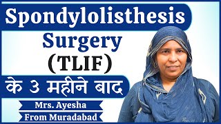 Spondylolisthesis Surgery (TLIF) के 3 महीने बाद | Spine Surgery In Delhi NCR