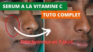 Sérum anti hyperpigmentation à la VITAMINE C