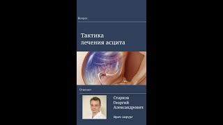 Тактика лечения асцита