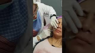 0811 1721 280, Filler hidung dekat Cawang Rinanda  Skin Care Center