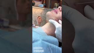 Expert Threadlifting Procedure in Dubai | Non-Surgical Face Lift at EDEN Aesthetic Clinic