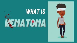 What is a hematoma?, Hematoma impaired wound healing