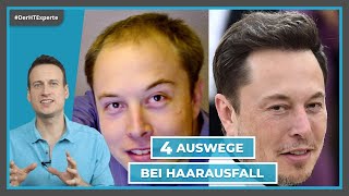 MÄNNER und HAARAUSFALL ► 4 Behandlungsmöglichkeiten bei Haarverlust◄