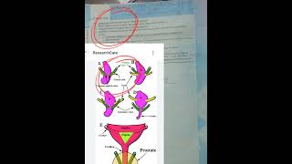 ureter abnormalities|Fcps part-1 preparation forum|embryology lectures|how to pass Fcps part-1