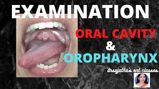 075.Examination of Oropharynx and Oral Cavity  #clinicalexamination #oralcavity #tongue