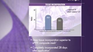 Genzyme Sepramesh IP