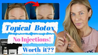 Is topical Botox Worth It? | Dr. Hydrotox | Scullplla | Over 40 | Before and Afters