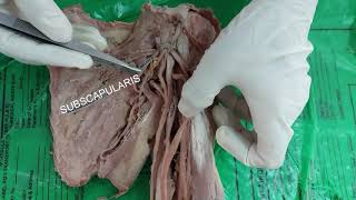 Dissection: Scapular Region including Spaces around Scapula