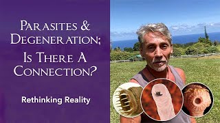 Rethinking Reality: Parasites and Degeneration; Is There A Connection? | Dr. Robert Cassar