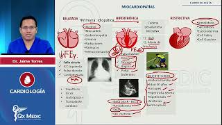 2024 CARDIOLOGÍA   Miocardiopatías  Miocardiopatías CARDIOLOGÍA   Endocarditis infecciosa  E