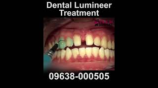 Dental luminaires Treatment ll Tech Dental