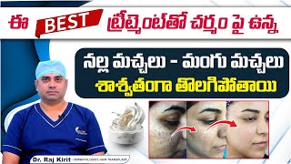 Laser Treatment for Dark Spots on Face | Dark Spots on Face Removal | Celestee Skin And Hair Clinic