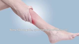 ЗАБОЛЕВАНИЯ ПЕРИФЕРИЧЕСКИХ СОСУДОВ — СИМПТОМЫ И ЛЕЧЕНИЕ / Peripheral vascular disease