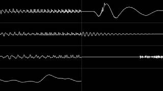 Mario's Mystery Meat - "Sicko Mode Room/Despacito" [Oscilloscope View]