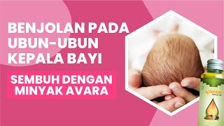 Testimoni Benjolan Pada Ubun-Ubun Kepala Bayi Sembuh Dengan Minyak Avara || Varash Saddan Nusantara