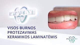 Visos burnos protezavimas keramikos laminatėmis