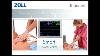 R Series Monitor Defibrillator Intro