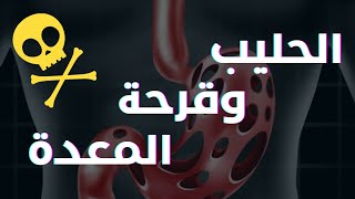 اللبن وعلاقته بقرحة المعدة | اعراض قرحة المعدة | امراض المعدة والحليب | اعراض ارتجاع المرئ