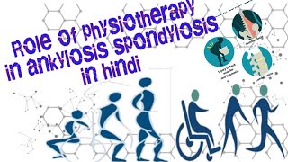 Role of Physiotherapy in Ankylosing spondylitis आंक्यलोसिंग स्पॉन्डिलाइटिस फिज़ियोथेरेपी की महत्वता