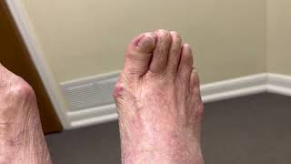 What Do 100 Year Old Feet Look Like?