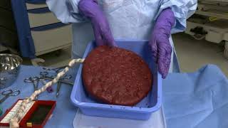 How to Deliver and Inspect the Placenta | Merck Manual Professional Version