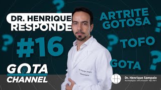 Dr. Henrique Responde #16 Sua pergunta pode estar aqui! Tofo - Gota - Artrite Gotosa - Crise de Gota