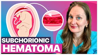 Subchorionic Hematoma and Bleeding in Pregnancy: What to Expect and How to Manage It