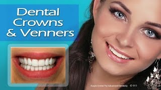 Dental Crowns & Veneers