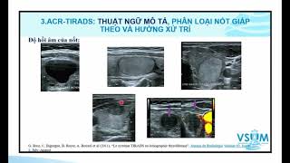 Phân loại siêu âm nốt giáp theo ACR-TIRADS 2017