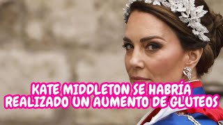 ¿Kate Middleton Oculta una Cirugía Estética? Descubre los Sorprendentes Rumores