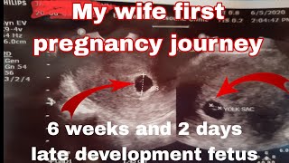 ultrasound result 6 weeks and 2 days yolk and sac fetus late development to much hurts for me before