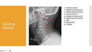 Columna Cervical