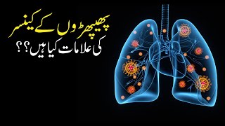 What Are The Symptoms Of Lung Cancer? | Phepron Ke Cancer Ki Alamaat Kia Hain | Metahealth