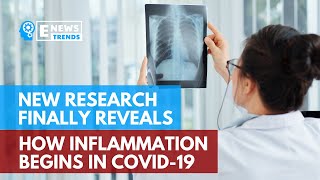 New Research Finally Reveals How Inflammation Begins in COVID-19