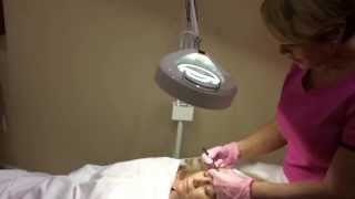 Dr. Wigoda Offers Medical Facial Services Like Dermaplaning