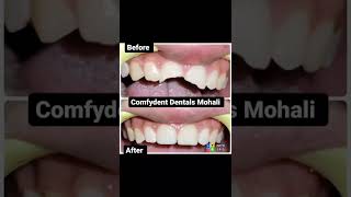 comfydent Dentals sector-115, mohali