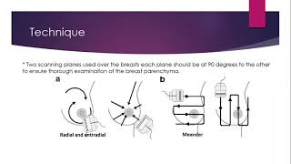 Breast Ultrasound scanning tips and common pathologies